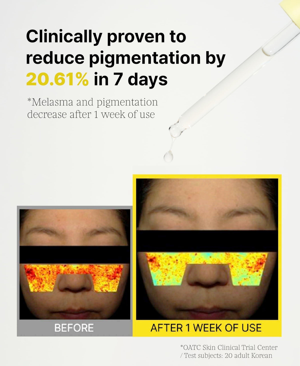 3% TXA Vitamin Serum for Face Brightening Vitamin Serum 1.01 Fl.Oz for Dark Spots and Uneven Skin Tone