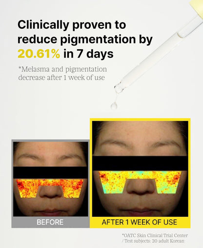 3% TXA Vitamin Serum for Face Brightening Vitamin Serum 1.01 Fl.Oz for Dark Spots and Uneven Skin Tone