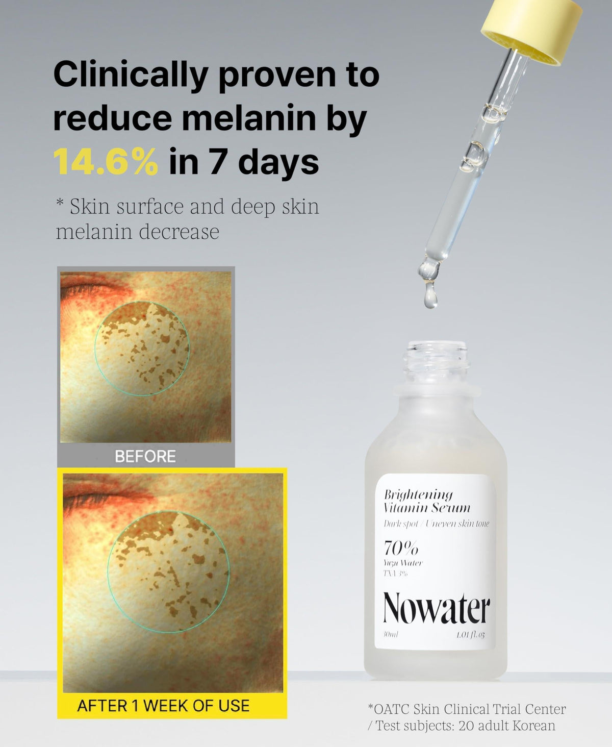 3% TXA Vitamin Serum for Face Brightening Vitamin Serum 1.01 Fl.Oz for Dark Spots and Uneven Skin Tone